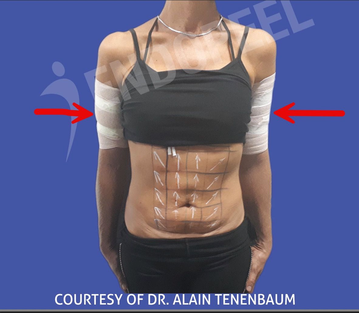 arm-contention