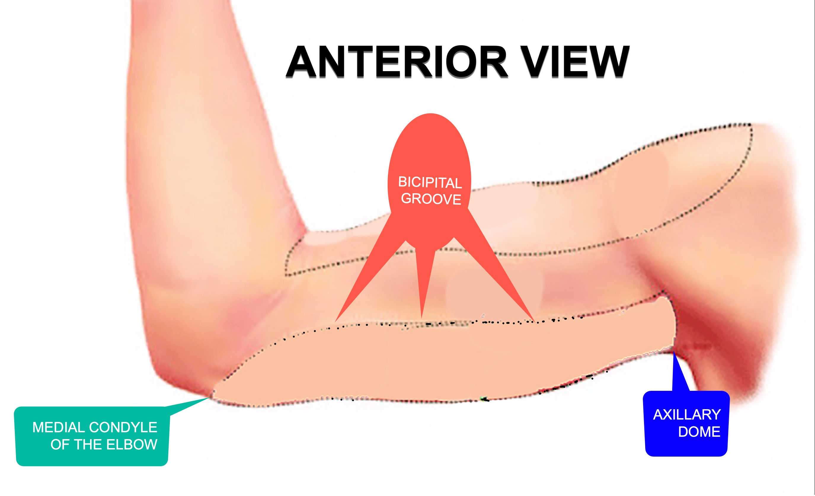 limits-anterior-bingo-wings