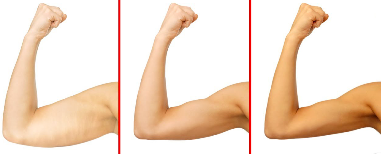 arms 3x