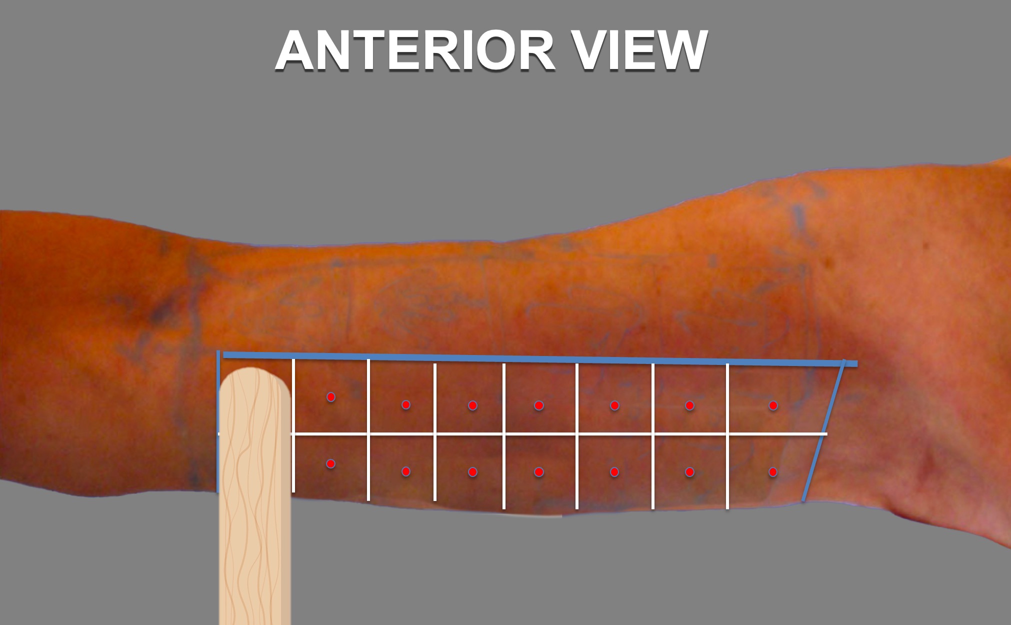 Step5.1-Vectors-Anterior-View