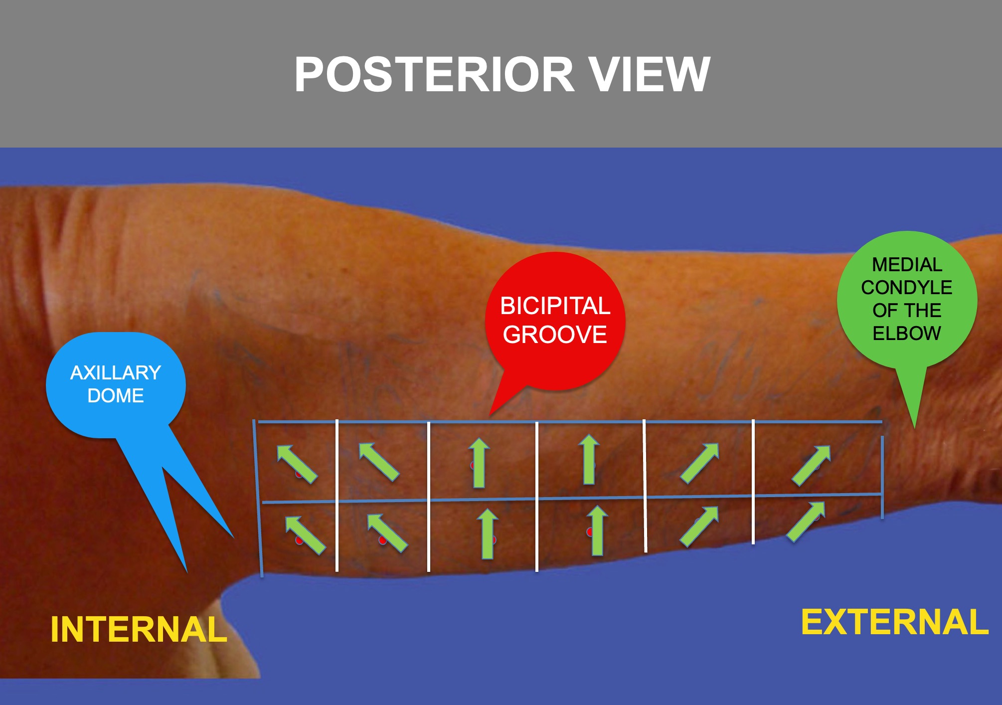 Step8-TENSORS-POSTERIOR-VIEW
