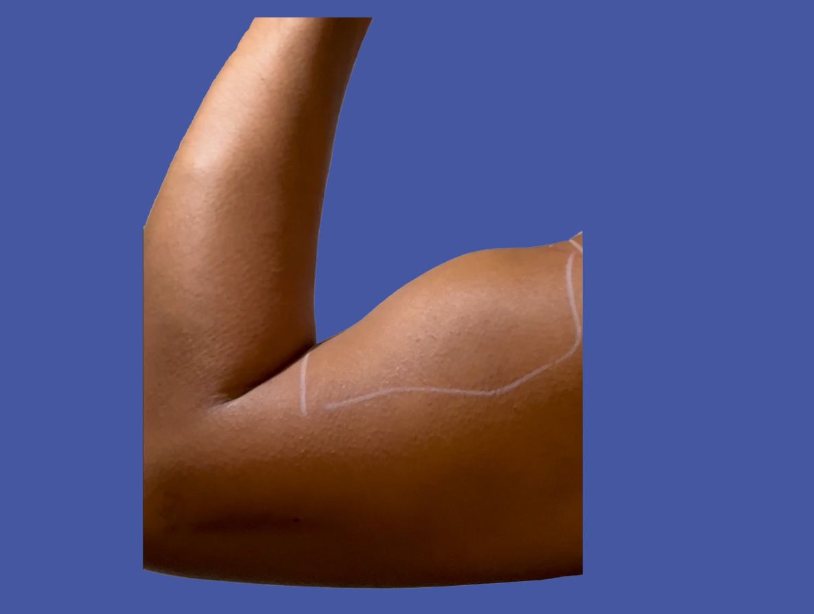 posterior-view-marking-biceps