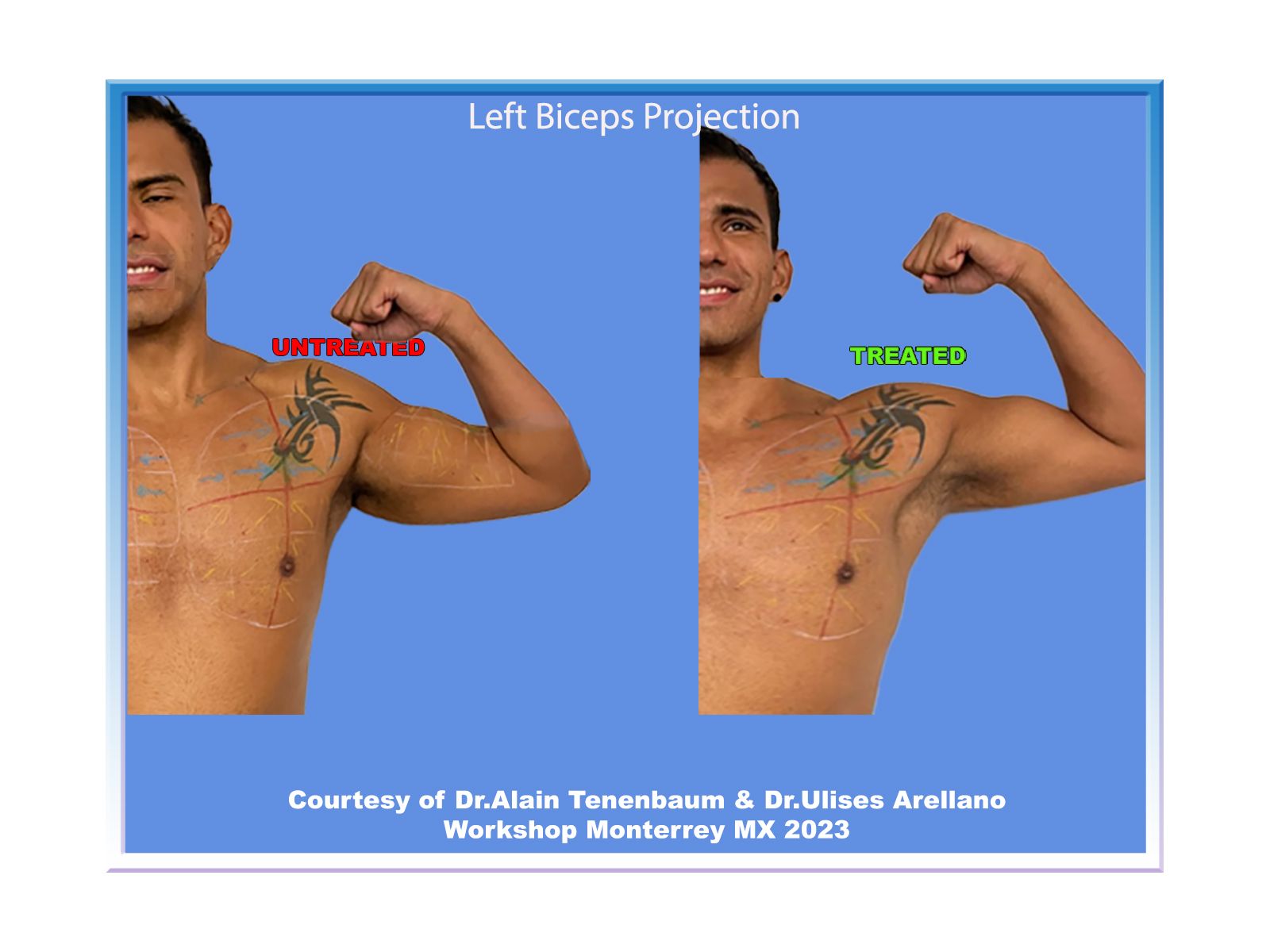 biceps projection for males