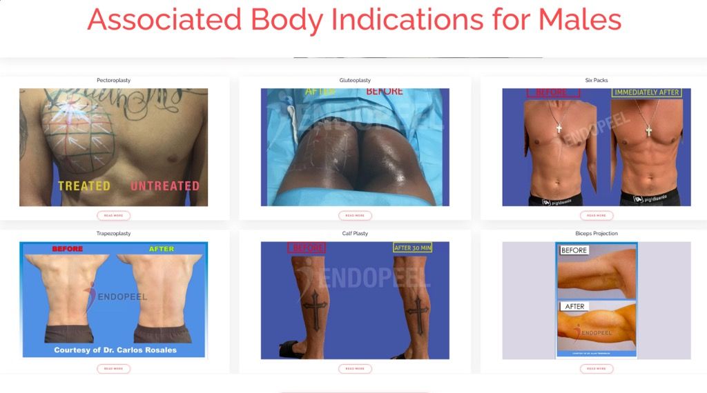 associated-body-indications-for-males