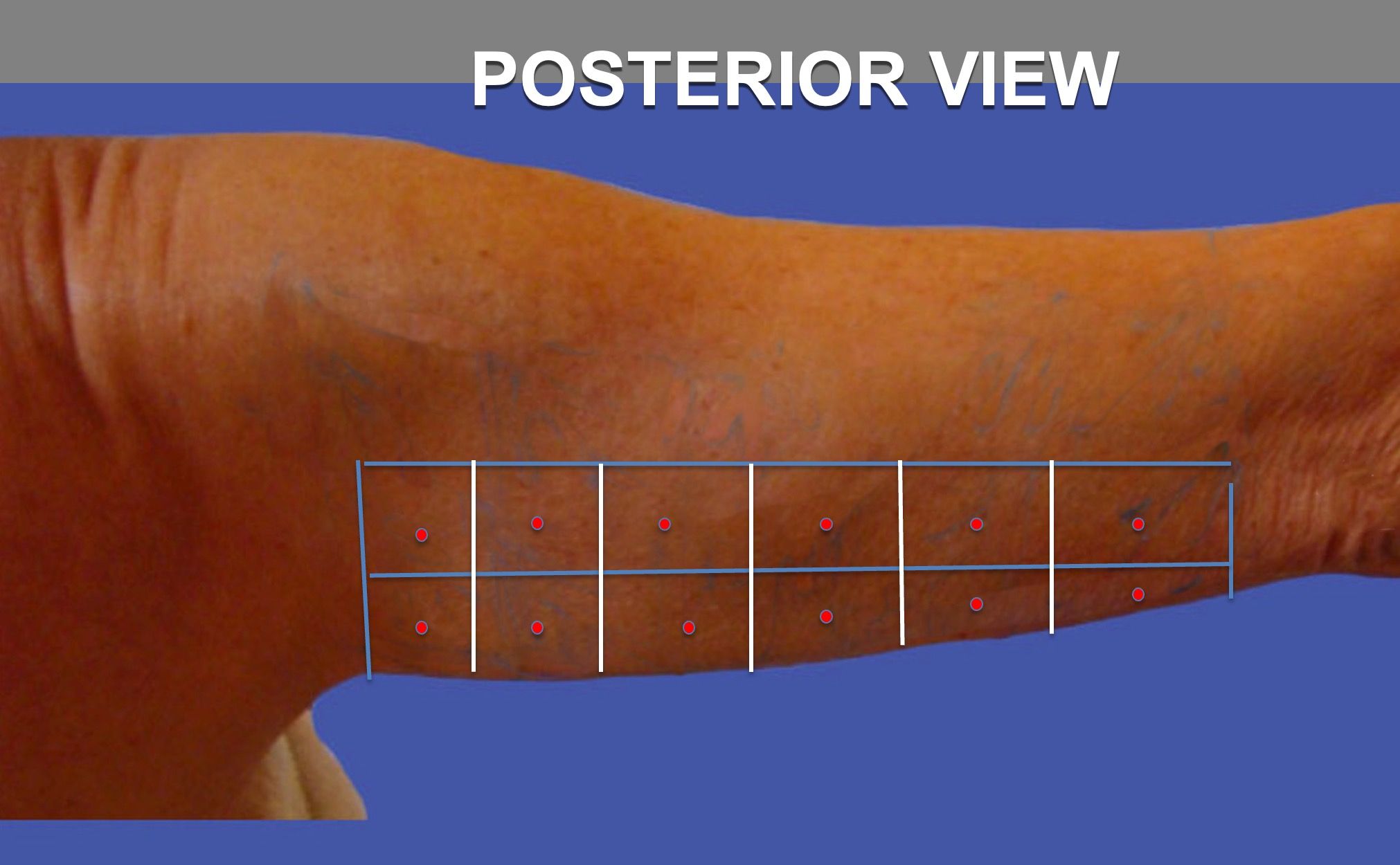 6.2-vectors-posterior