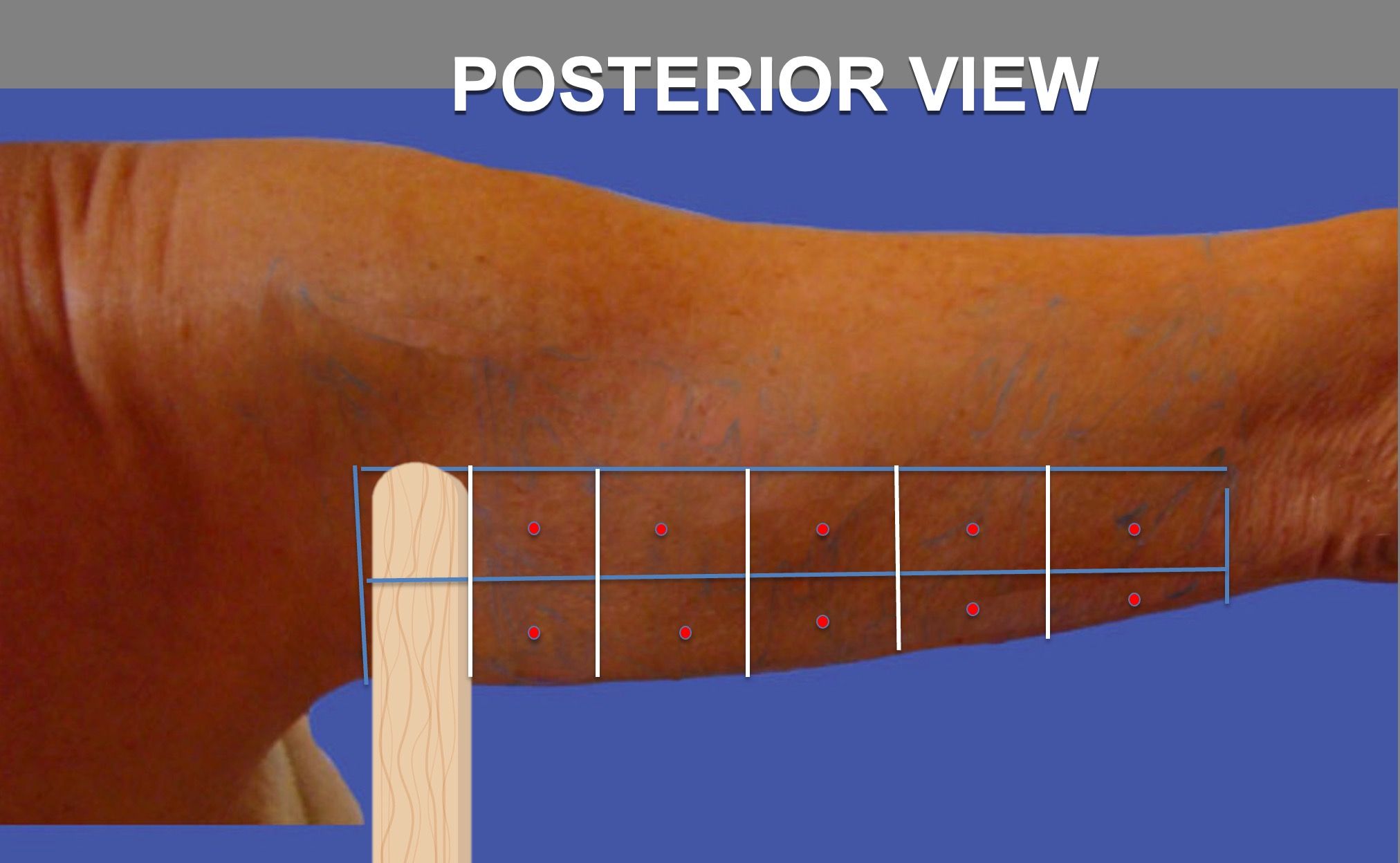 Step6.1-vectors-posterior-view