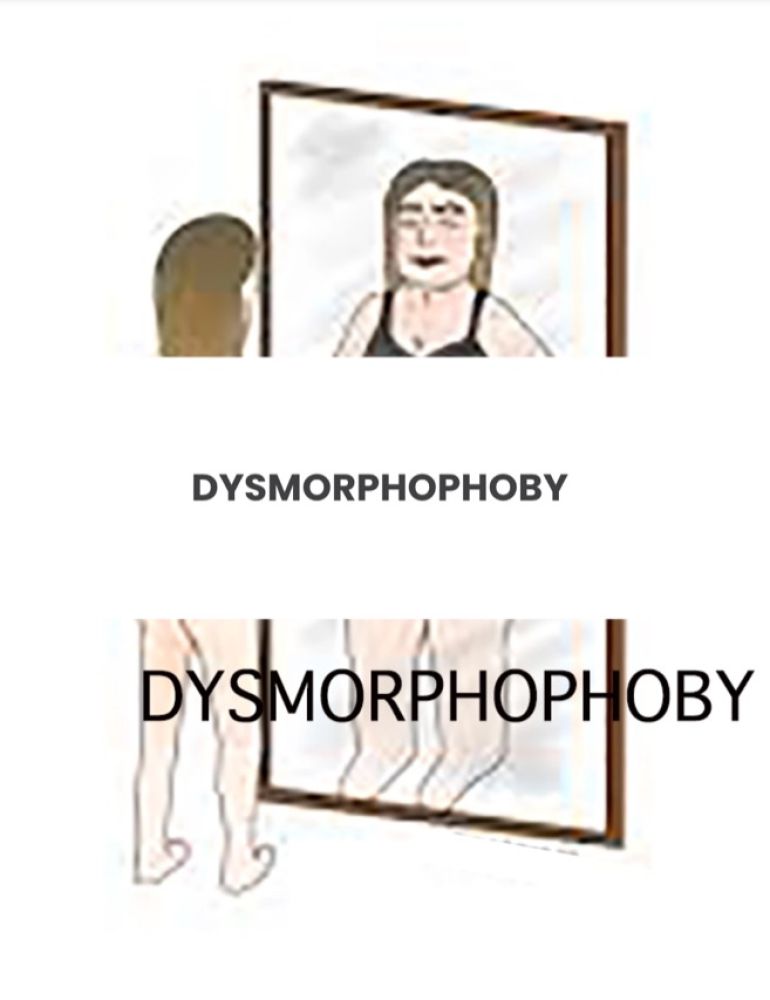 dysmorphophoby